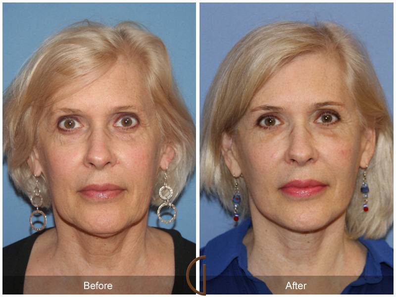 Plastic surgery research papers