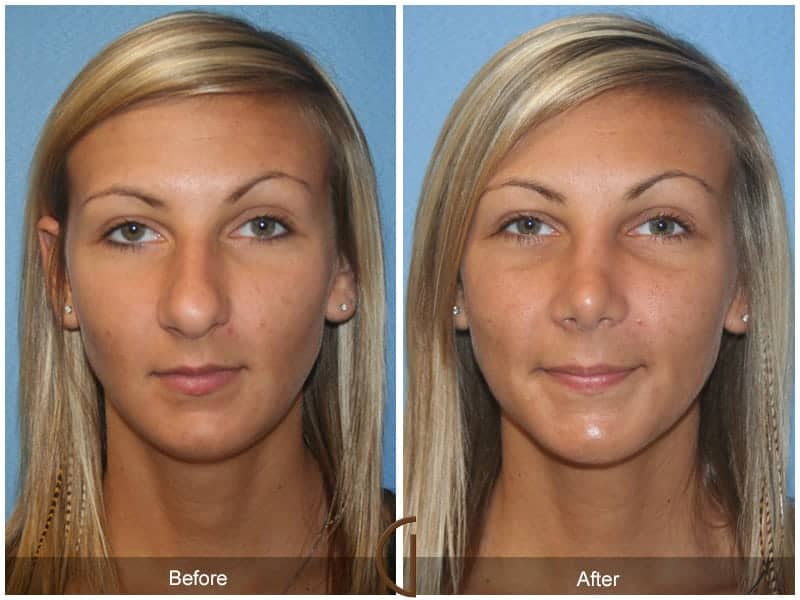 Real ephedra diet pills photo 8
