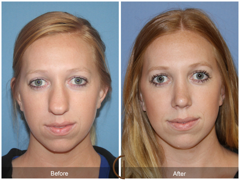 Weight loss challenge evaluation image 3